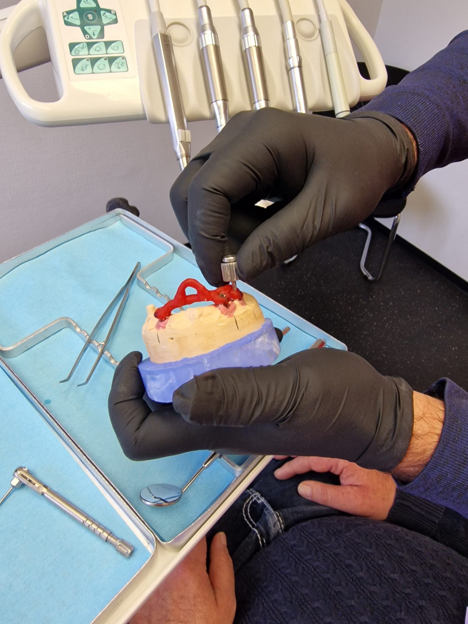 Teleskopierende Prothese - Bild 1