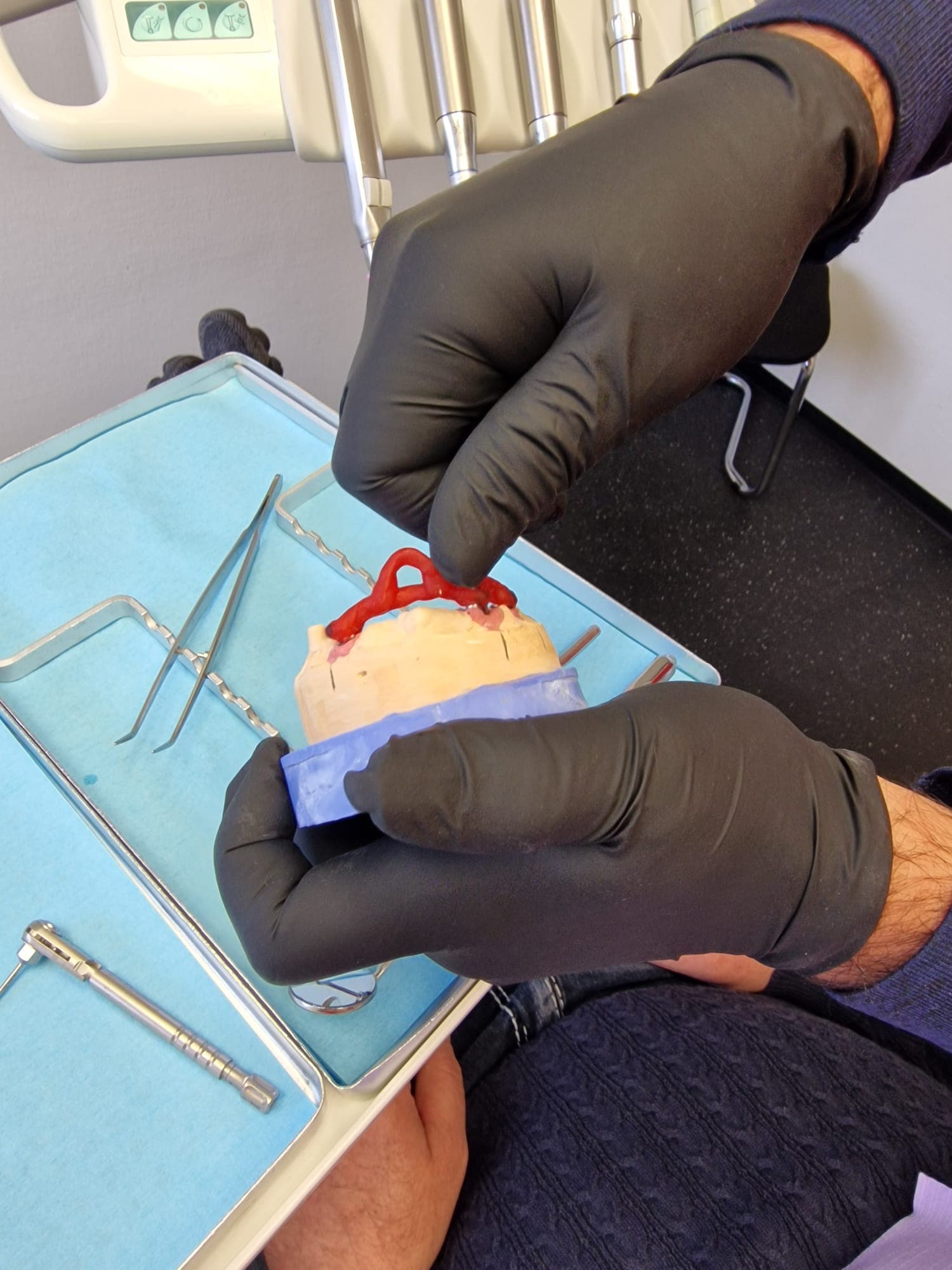 Teleskopierende Prothese - Bild 12